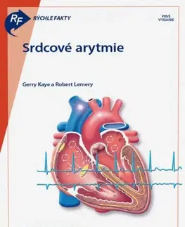 Medicína - ostatné Rýchle fakty: Srdcové arytmie - Kolektív autorov