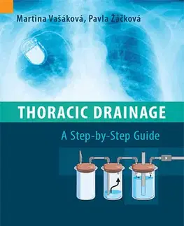 Medicína - ostatné Thoracic Drainage / A Step-by-Step Guide - Kolektív autorov