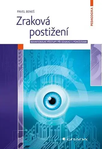 Medicína - ostatné Zraková postižení - Pavel Beneš