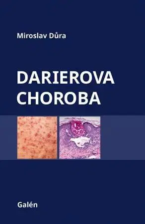 Medicína - ostatné Darierova choroba - Miroslav Důra
