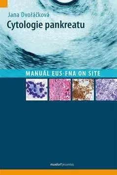 Medicína - ostatné Cytologie pankreatu - Jana Dvořáčková