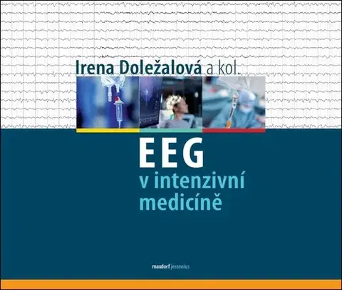 Medicína - ostatné EEG v intenzivní medicíně - Irena Doležalová