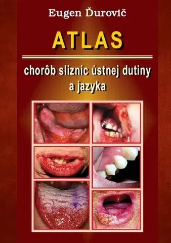 Medicína - ostatné Atlas chorôb slizníc ústnej dutiny a jazyka - Eugen Ďurovič