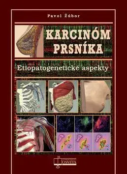 Medicína - ostatné Karcinóm prsníka - Pavol Žúbor