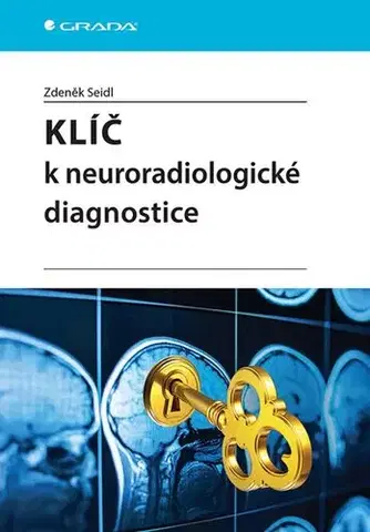 Medicína - ostatné Klíč k neuroradiologické diagnostice - Zdeněk Seidl