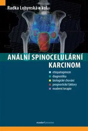 Onkológia Anální spinocelulární karcinom - Radka Lohynská