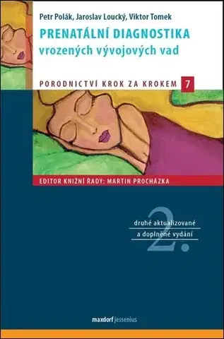 Medicína - ostatné Prenatální diagnostika vrozených vývojových vad, 2. vydání - Jaroslav Loucký,Petr Polák,Viktor Tomek