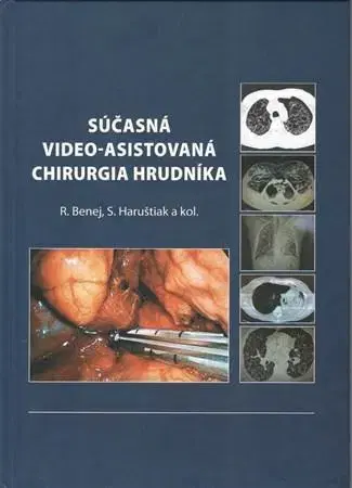Chirurgia, ortopédia, traumatológia Súčasná video-asistovaná chirurgia hr... - Roman Benej,Svetozár Haruštiak