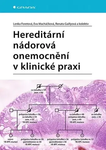 Medicína - ostatné Hereditární nádorová onemocnění v klinické praxi - Lenka Foretová,Renata Gaillyová,Kolektív autorov,Eva Macháčková