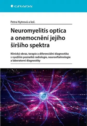 Medicína - ostatné Neuromyelitis optica a poruchy jejího širšího spektra - Petra Nytrová,Kolektív autorov