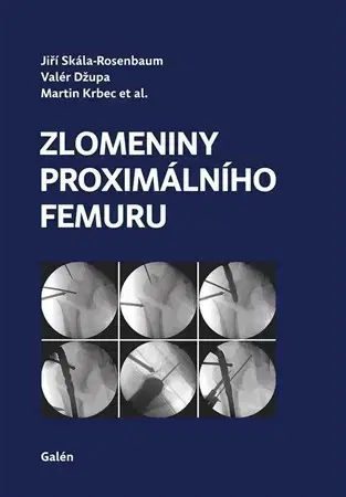 Medicína - ostatné Zlomeniny proximálního femuru - Kolektív autorov