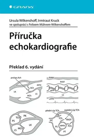 Medicína - ostatné Příručka echokardiografie - Ursula Wilkenshoff