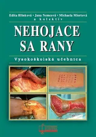 Medicína - ostatné Nehojace sa rany - Edita Hlinková,Jana Nemcová,Michaela Miertová