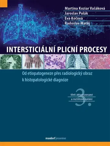 Medicína - ostatné Intersticiální plicní procesy, 3. vydání - Martina Vašáková,Jaroslav Polák,Matěj Radoslav