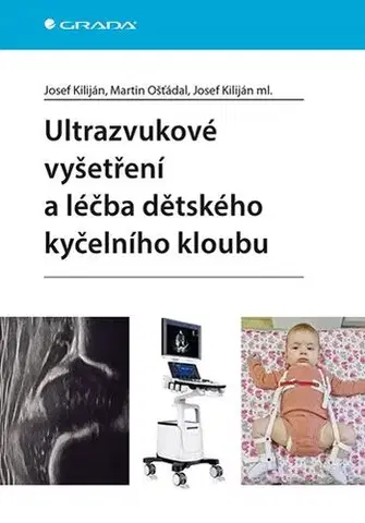 Medicína - ostatné Ultrazvukové vyšetření a léčba dětského kyčelního kloubu - Josef Kiliján,Martin Ošťádal,Josef Kiliján ml.,Kolektív autorov