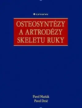 Medicína - ostatné Osteosyntézy a artrodézy skeletu ruky - Pavel Maňák,Pavel Dráč