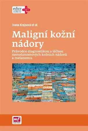 Medicína - ostatné Maligní kožní nádory - Ivana Krajsová