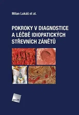 Medicína - ostatné Pokroky v diagnostice a léčbě idiopatických střevních zánětů - Kolektív autorov,Milan Lukáš