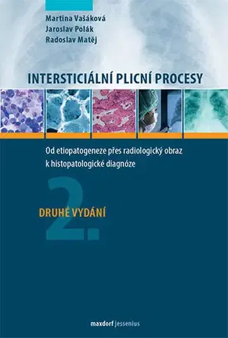 Medicína - ostatné Intersticiální plicní procesy - Kolektív autorov