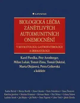 Medicína - ostatné Biologická léčba zánětlivých autoimunitních onemocnění - Kolektív autorov
