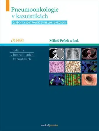 Medicína - ostatné Pneumoonkologie v kazuistikách - Kolektív autorov,Miloš Pešek
