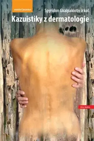 Medicína - ostatné Kazuistiky z dermatologie - Kolektív autorov,Spyridon Gkalpakiotis