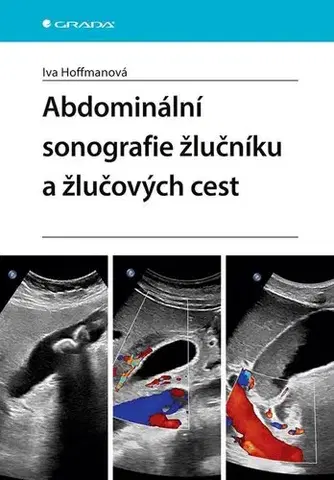 Medicína - ostatné Abdominální sonografie žlučníku a žlučových cest - Iva Hoffmanová