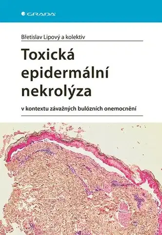 Medicína - ostatné Toxická epidermální nekrolýza - Břetislav Lipový,Kolektív autorov