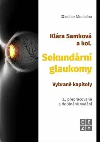 Medicína - ostatné Sekundární glaukomy. Vybrané kapitoly, 3. vydání - Kolektív autorov