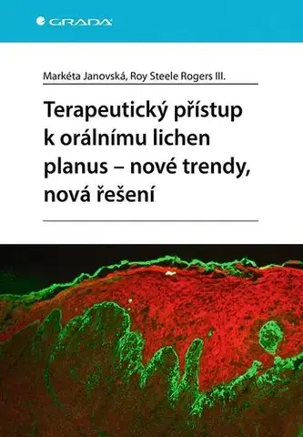 Medicína - ostatné Terapeutický přístup k orálnímu lichen planus - nové trendy, nová řešení - Markéta Janovská,Roy Steele Rogers III.
