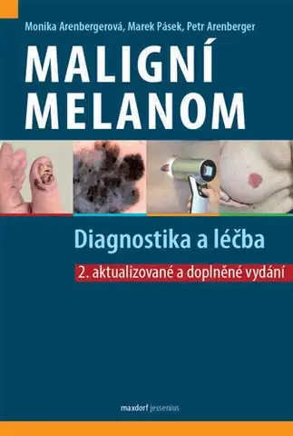 Medicína - ostatné Maligní melanom: Diagnostika a léčba, 2. vydání