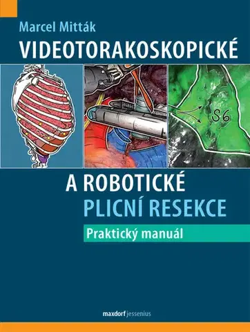 Chirurgia, ortopédia, traumatológia Videotorakoskopické a robotické plicní resekce - Praktický manuál - Marcel Mitták