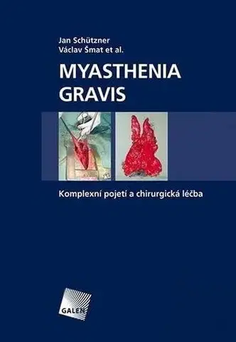 Medicína - ostatné MYASTHENIA GRAVIS