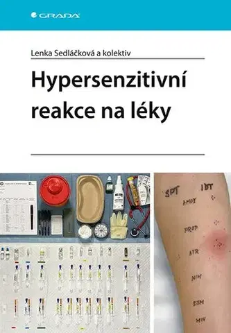 Medicína - ostatné Hypersenzitivní reakce na léky - Lenka Sedláčková,Kolektív autorov