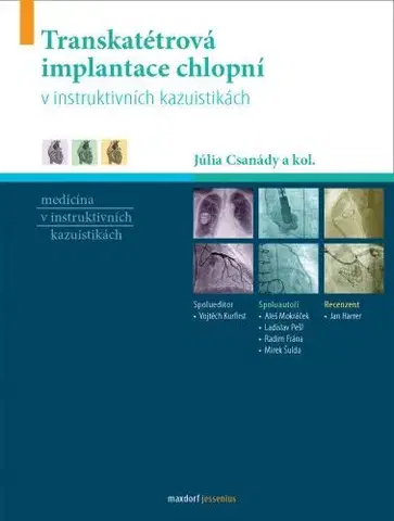 Medicína - ostatné Transkatétrová implantace chlopní v instruktivních kazuistikách - Júlia Csanády