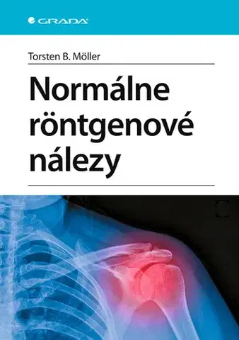 Medicína - ostatné Normálne röntgenové nálezy - Torsten B. Möller