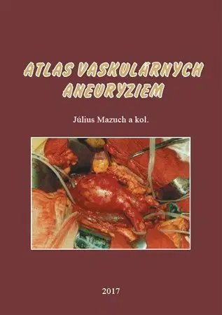 Medicína - ostatné Atlas vaskulárnych aneuryziem - Július Mazúch