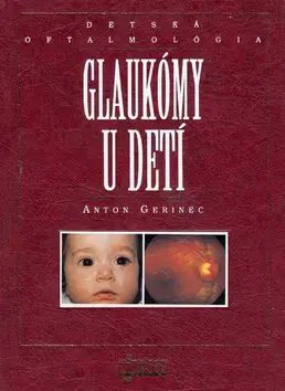 Medicína - ostatné Glaukómy u detí - Anton Gerinec