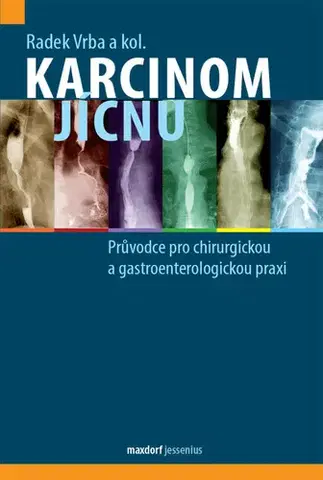 Chirurgia, ortopédia, traumatológia Karcinom jícnu - Radek Vrba,Kolektív autorov