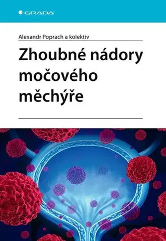 Onkológia Zhoubné nádory močového měchýře - Alexandr Poprach,Kolektív autorov
