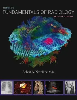 Medicína - ostatné Squires Fundamentals of Radiology - Robert A. Novelline
