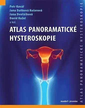 Medicína - ostatné Atlas panoramatické hysteroskopie - Kolektív autorov