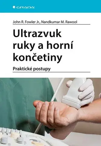 Medicína - ostatné Ultrazvuk ruky a horní končetiny - John R. Fowler,Nandkumar M.Rawool