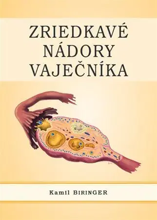 Onkológia Zriedkavé nádory vaječníka - Kamil Biringer