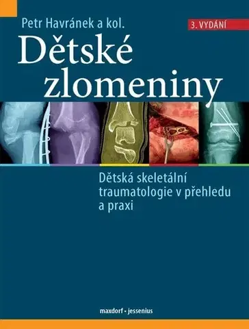 Chirurgia, ortopédia, traumatológia Dětské zlomeniny, 3. vydání - Petr Havránek