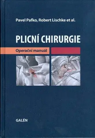 Medicína - ostatné Plicní chirurgie - Kolektív autorov,Pavel Pafko
