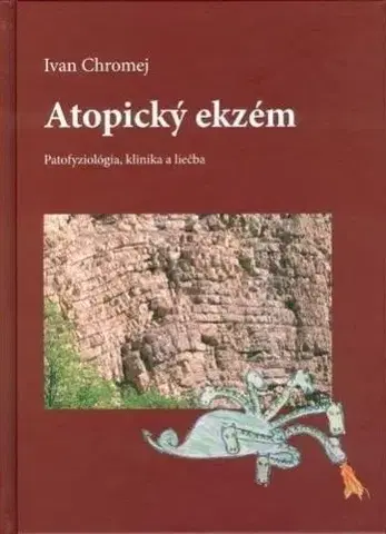 Medicína - ostatné Atopický ekzém - Ivan Chromej