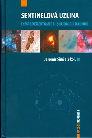 Medicína - ostatné Sentinelová uzlina - Kolektív autorov,Jaromír Šimša