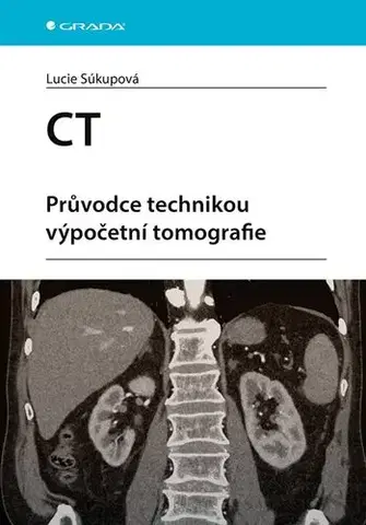 Medicína - ostatné CT - Průvodce technikou výpočetní tomografie - Lucie Súkupová