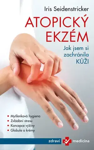 Alternatívna medicína - ostatné Jak jsem si zachránila kůži - Iris Seidenstricker